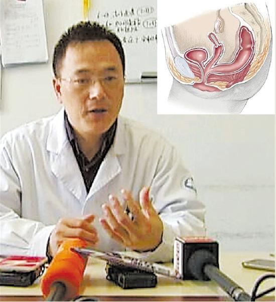 浙江1年近200例无肛宝宝出生 或与头两月孕期感染有关