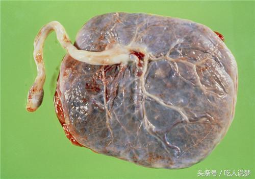 羊胎盘清洗步骤及其食疗功效