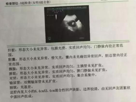 手术做到一半,之前查出的肿瘤不见了!更要命的是,医生竟要她切除子宫……