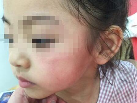 两幼儿争抢玩具,宁波年轻妈妈掌掴4岁小女孩!