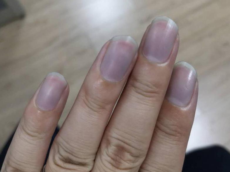 牛仔裤褪色正常?手指甲都变蓝了。我第一次买不懂