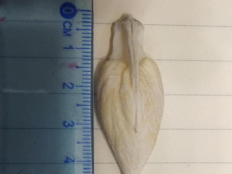 吃鱼吃出个稀罕物,这玩意儿值钱吗?