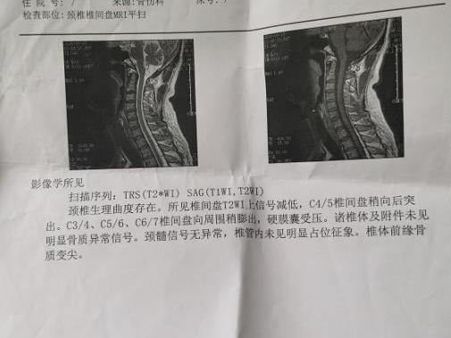 老公因为身体原因辞去公交司机工作,社保问题麻烦