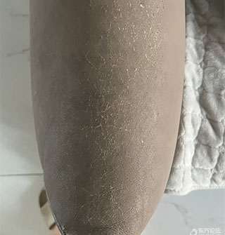 才买了两年的沙发，就爆皮成了这样